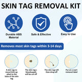 Skin Tag Removal Kit with Cleansing Swabs